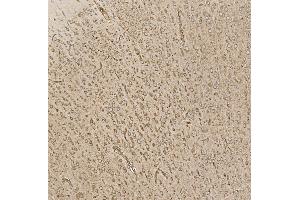 IHC analysis of EIF5 using anti-EIF5 antibody (ABIN7599722).