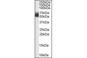 Image no. 2 for anti-F-Box and Leucine-Rich Repeat Protein 3 (FBXL3) (N-Term) antibody (ABIN372963) (FBXL3 Antikörper  (N-Term))