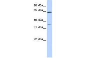 Image no. 1 for anti-Tripartite Motif Containing 45 (TRIM45) (AA 396-445) antibody (ABIN6740818) (TRIM45 Antikörper  (AA 396-445))