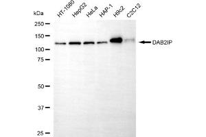 Western blotting analysis using DAB2IP antibody (ABIN7798271).