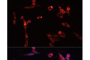 Immunofluorescence analysis of NIH/3T3 cells using MMP16 Polyclonal Antibody at dilution of 1:100.