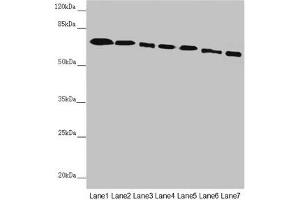 Western blot All lanes: DYNC1I1 antibody at 2. (DYNC1I1 Antikörper  (AA 1-220))
