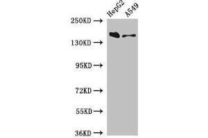 Western Blot Positive WB detected in: HepG2 whole cell lysate, A549 whole cell lysate All lanes: DOT1L antibody at 3 μg/mL Secondary Goat polyclonal to rabbit IgG at 1/50000 dilution Predicted band size: 185, 165 kDa Observed band size: 185 kDa (DOT1L Antikörper  (AA 331-484))