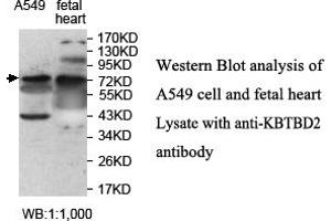 Image no. 1 for anti-Kelch Repeat and BTB (POZ) Domain Containing 2 (KBTBD2) antibody (ABIN1577433) (KBTBD2 Antikörper)