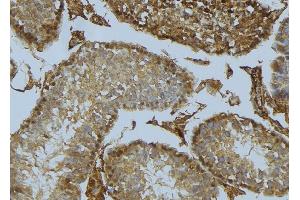 ABIN6275477 at 1/100 staining Mouse testis tissue by IHC-P. (RGS1 Antikörper  (Internal Region))