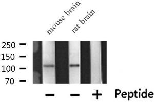 Western blot analysis of PKN1/PRK1 expression in various lysates (PKN1 Antikörper  (Internal Region))