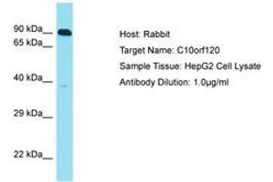 Image no. 1 for anti-Chromosome 10 Open Reading Frame 120 (C10ORF120) (AA 223-272) antibody (ABIN6750814) (C10ORF120 Antikörper  (AA 223-272))