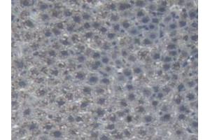 IHC-P analysis of Rat Liver Tissue, with DAB staining. (AGT Antikörper)