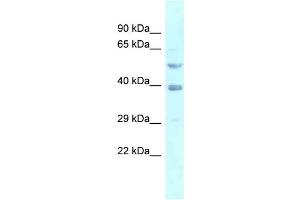 WB Suggested Anti-FEN1 Antibody Titration: 1. (FEN1 Antikörper  (N-Term))