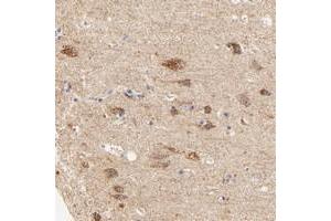 Immunohistochemical staining of human cerebral cortex with ATP5D polyclonal antibody  shows strong cytoplasmic positivity in granular pattern in neuronal cells. (ATP5F1D Antikörper)
