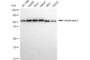 Western blotting analysis using hexokinase 2 antibody (ABIN7798907).