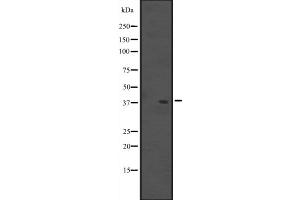 Western blot analysis of MUL1 expression in A431 whole cell lysate ,The lane on the left is treated with the antigen-specific peptide. (MUL1 Antikörper  (Internal Region))