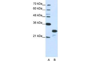 WB Suggested Anti-ANP32A Antibody Titration:  1. (PHAP1 Antikörper  (N-Term))