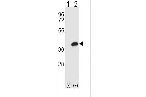 Western blot analysis of AKR1B1 using rabbit polyclonal AKR1B1 Antibody using 293 cell lysates (2 ug/lane) either nontransfected (Lane 1) or transiently transfected (Lane 2) with the AKR1B1 gene. (AKR1B1 Antikörper  (AA 102-135))