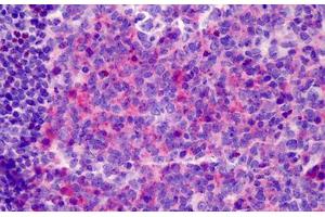 Human Tonsil: Formalin-Fixed, Paraffin-Embedded (FFPE)