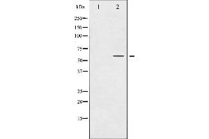 Western blot analysis of Tyrosine Hydroxylase phosphorylation expression in UV treated 293 whole cell lysates,The lane on the left is treated with the antigen-specific peptide. (Tyrosine Hydroxylase Antikörper  (pSer31))