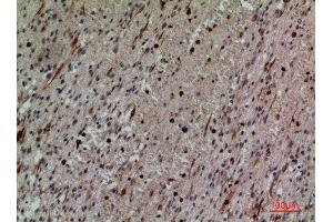 Immunohistochemistry (IHC) analysis of paraffin-embedded Human Brain, antibody was diluted at 1:100.