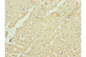 Immunohistochemistry (IHC) image for anti-Ubiquinol-Cytochrome C Reductase Core Protein II (UQCRC2) (AA 224-453) antibody (ABIN7149107)