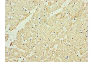 Immunohistochemistry of paraffin-embedded human heart tissue using ABIN7149107 at dilution of 1:100 (UQCRC2 Antikörper  (AA 224-453))