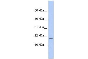 RPS15 antibody used at 1 ug/ml to detect target protein. (RPS15 Antikörper  (Middle Region))