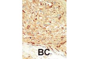 Immunohistochemistry (IHC) image for anti-Macrophage Stimulating 1 (Hepatocyte Growth Factor-Like) (MST1) antibody (ABIN3003576) (MST1 Antikörper)