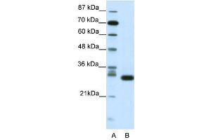 CDK5 antibody (20R-1201) used at 0. (CDK5 Antikörper  (N-Term))