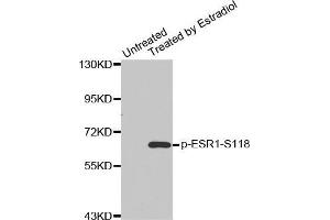 Western blot analysis of extracts from MDA cells using Phospho-ESR1-S118 antibody. (Estrogen Receptor alpha Antikörper  (pSer118))