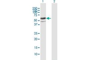 Western Blot analysis of ENTPD8 expression in transfected 293T cell line by ENTPD8 MaxPab polyclonal antibody. (ENTPD8 Antikörper  (AA 1-458))