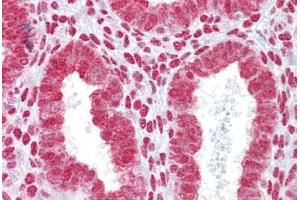 Anti-HOXA11 antibody IHC staining of human uterus.