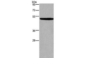 Western Blot analysis of NIH/3T3 cell using KCNN4 Polyclonal Antibody at dilution of 1:450 (KCNN4 Antikörper)