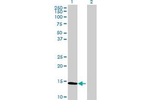 Western Blot analysis of CALCA expression in transfected 293T cell line by CALCA MaxPab polyclonal antibody. (CGRP Antikörper  (AA 1-141))