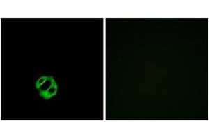 Immunofluorescence analysis of MCF7 cells, using AGTRL1 Antibody. (Apelin Receptor Antikörper  (AA 141-190))
