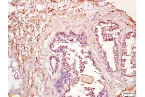 Formalin-fixed and paraffin embedded human prostate labeled with Anti-PDGF-D Polyclonal Antibody, Unconjugated (ABIN714581) at 1:200 followed by conjugation to the secondary antibody and DAB staining (PDGFD Antikörper  (AA 271-370))