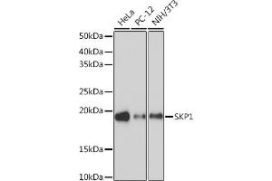 Western blot analysis of extracts of various cell lines, using SKP1 Rabbit mAb (ABIN7270120) at 1:1000 dilution. (SKP1 Antikörper)