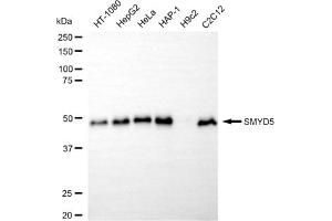 Western blotting analysis using SMYD5 antibody (ABIN7800383).