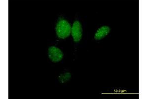 Immunofluorescence of purified MaxPab antibody to IRF2 on HeLa cell. (IRF2 Antikörper  (AA 1-349))