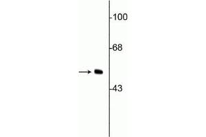 Western blot of HeLa cell lysate showing specific immunolabeling of the ~50 kDa vimentin protein. (Vimentin Antikörper)