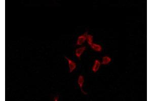 ABIN6274429 staining HepG2 by IF/ICC. (ACRBP Antikörper  (Internal Region))