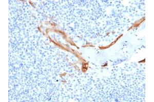 Formalin-fixed, paraffin-embedded human Tonsil stained with Cytokeratin 16 Mouse Monoclonal Antibody (SPM264). (KRT16 Antikörper  (C-Term))