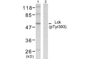 Western blot analysis of extracts from MOLT cells using Lck (phospho-Tyr393) antibody (E011144). (LCK Antikörper  (pTyr393))