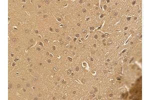 NAA40 Mouse Monoclonal Antibody at 1/100 staining rat brain tissue by IHC-P. (NAA40 Antikörper)