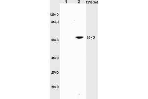 SDS-PAGE (SDS) image for anti-Tumor Necrosis Factor Receptor Superfamily, Member 8 (TNFRSF8) (AA 131-230) antibody (ABIN741090)