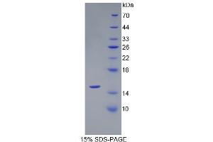SDS-PAGE (SDS) image for Anti-Mullerian Hormone (AMH) (AA 447-553) protein (His tag) (ABIN1078850)