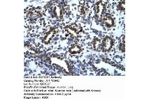 Human Lung (TGFB1I1 Antikörper  (Middle Region))