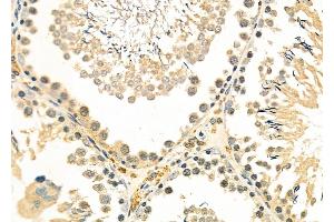 ABIN6263446 and ABIN6276875 at 1/100 staining Rat testis tissue by IHC-P. (MX1 Antikörper  (C-Term))