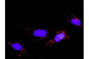 Proximity Ligation Analysis of protein-protein interactions between FGFR2 and FGF5.