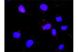 Proximity Ligation Assay (PLA) image for anti-E2F Transcription Factor 1 (E2F1) (AA 348-437) antibody (ABIN560676)