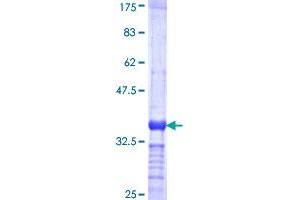 RNASE2 Protein (AA 86-161) (GST tag)