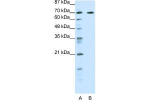 WB Suggested Anti-FOXK2 Antibody Titration:  0.