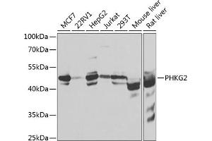 Western blot analysis of extracts of various cell lines, using PHKG2 antibody  at 1:1000 dilution. (PHKG2 Antikörper  (AA 237-406))